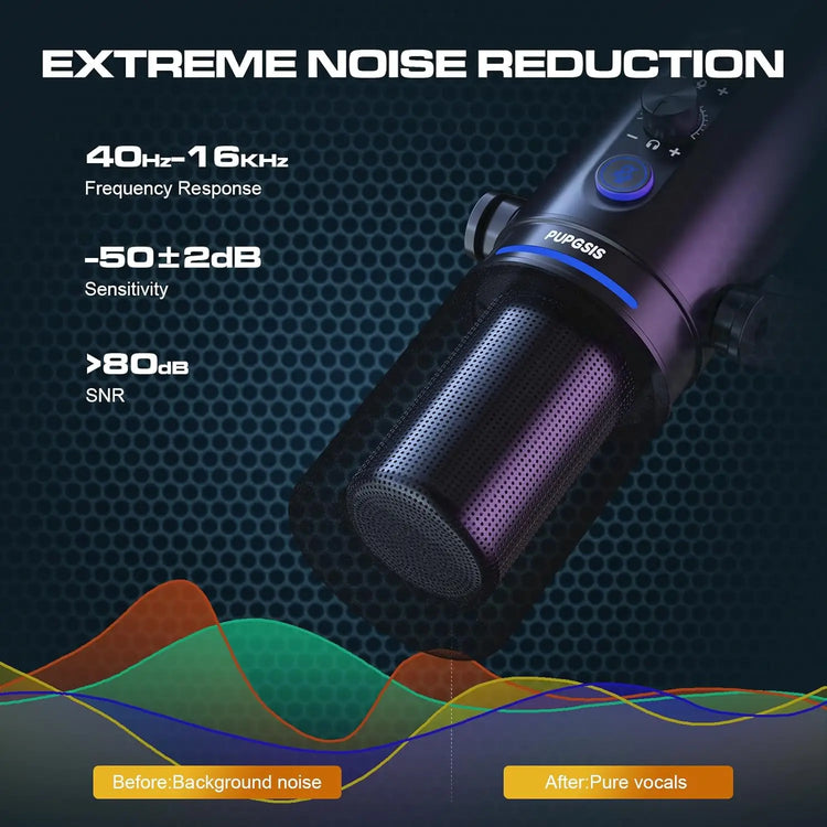 ORTIZAN Podcast Dynamic Microphone, XLR/USB Recording PC - ElectronAge