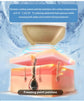 All-in-OneBeauty Device for Permanent Hair Removal & Pigment Treatment - ElectronAge