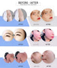 All-in-OneBeauty Device for Permanent Hair Removal & Pigment Treatment - ElectronAge