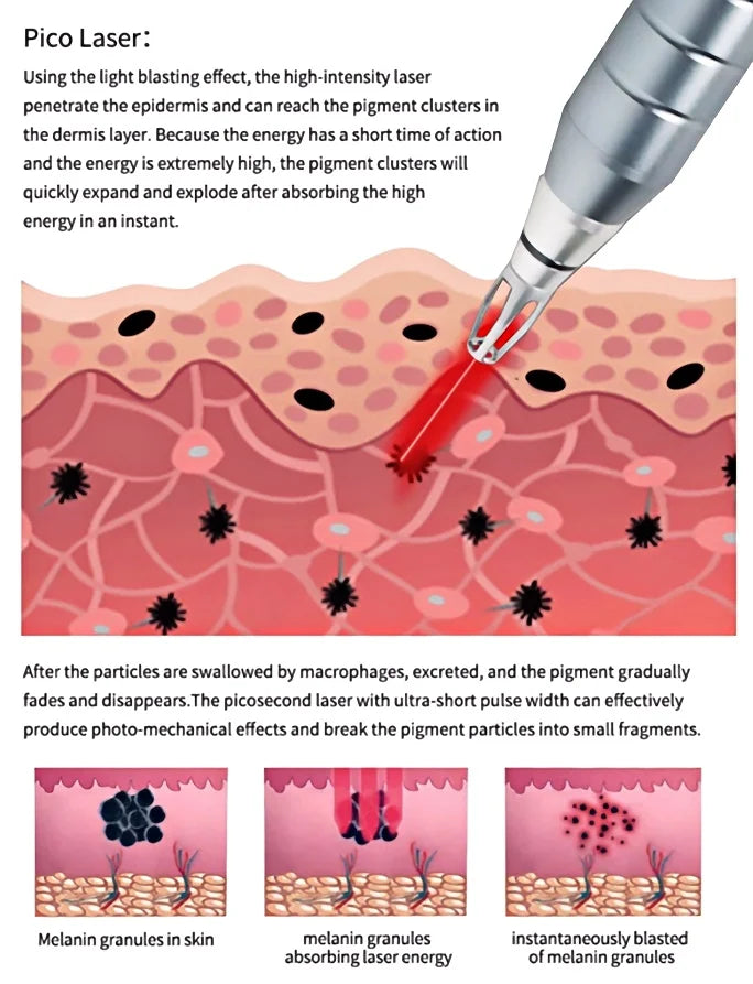 All-in-OneBeauty Device for Permanent Hair Removal & Pigment Treatment - ElectronAge