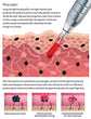 All-in-OneBeauty Device for Permanent Hair Removal & Pigment Treatment - ElectronAge