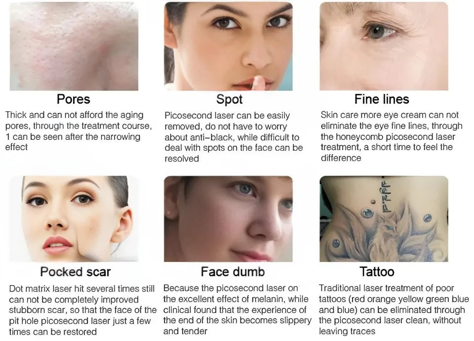 All-in-OneBeauty Device for Permanent Hair Removal & Pigment Treatment - ElectronAge