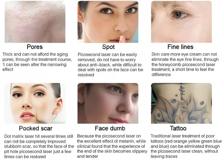 All-in-OneBeauty Device for Permanent Hair Removal & Pigment Treatment - ElectronAge