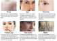 All-in-OneBeauty Device for Permanent Hair Removal & Pigment Treatment - ElectronAge