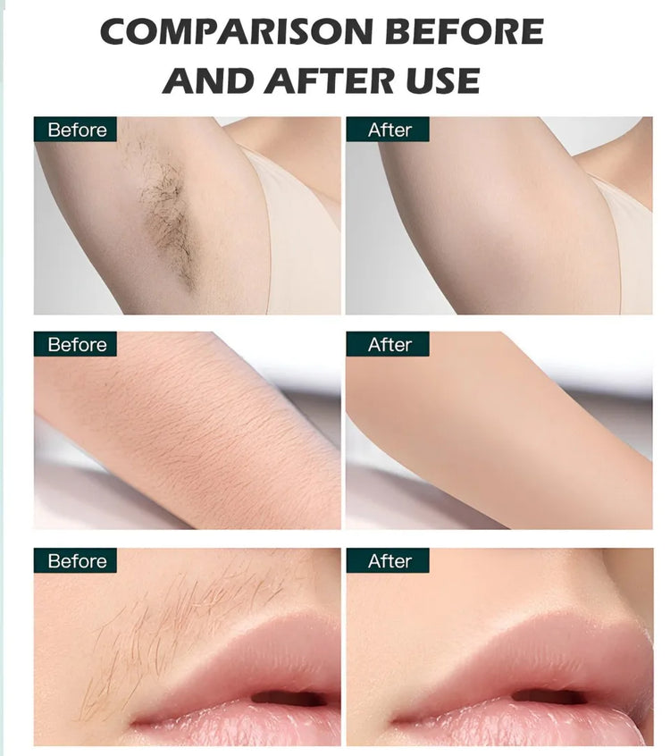 All-in-OneBeauty Device for Permanent Hair Removal & Pigment Treatment - ElectronAge