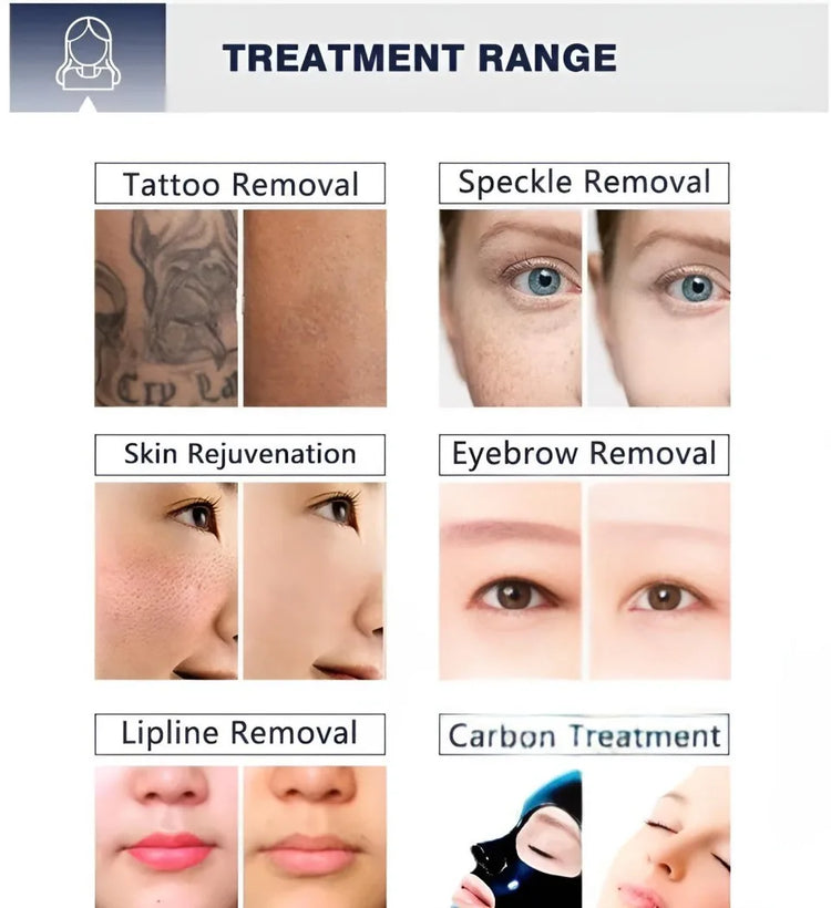 All-in-OneBeauty Device for Permanent Hair Removal & Pigment Treatment - ElectronAge