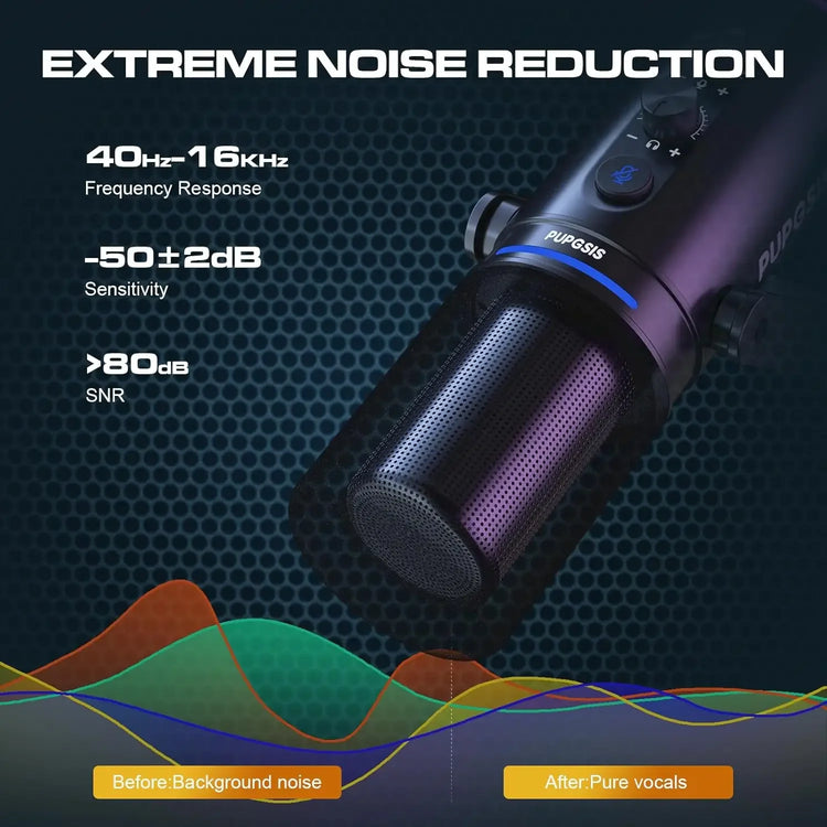 XLR/USB Gaming Microphone Kit: Dynamic PC Mic - ElectronAge